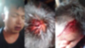 Sihai Khunou Public Council Demands Accountability Over Alleged Police Inaction in Attempted Murder Case